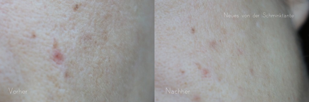 beforeafter5