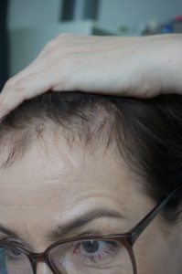 Basilikum gegen Haarausfall? Volleres Haar durch Rhizinussöl? Schminktante Anja Frankenhäuser hat die Haarkur von Rezilin ausprobiert.